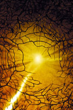 retina under the microscope microscopic retina photography art photo microscopy artwork